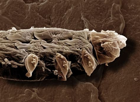 What are Demodex Mites? - Facty Health