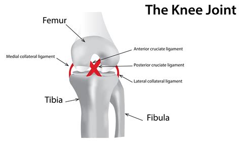 Knee Injuries | KneePain.com