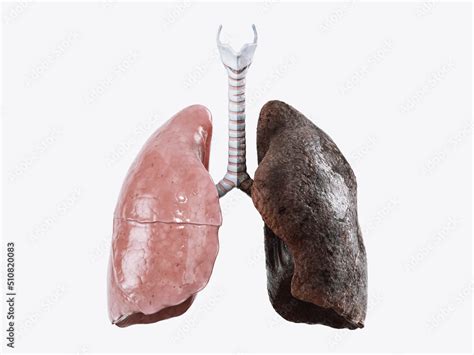 Realistic 3d illustration of healthy human lungs vs smoker lungs isolated on white background ...