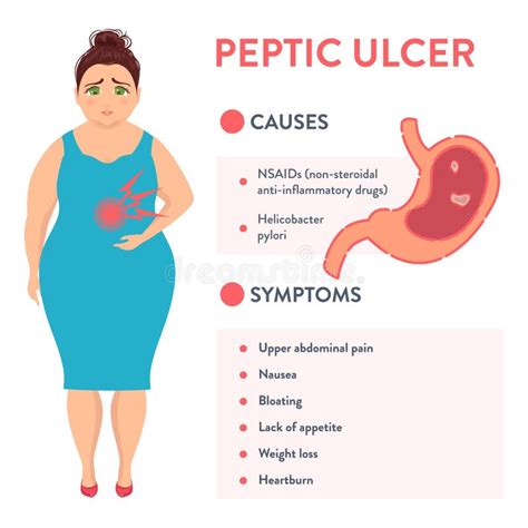 Causes and Symptoms of Peptic Ulcer Stomach Disease Stock Illustration ...