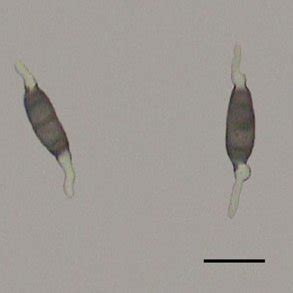 Typical symptoms of sugarcane leaf spot caused by Bipolaris spicifera... | Download Scientific ...