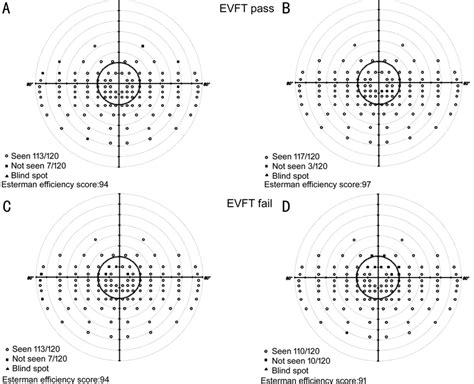 Binocular Esterman visual field test results A, B: Patients pass... | Download Scientific Diagram