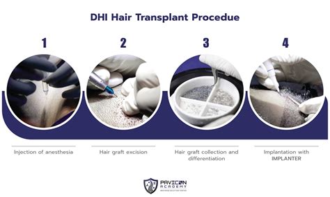 DHI Hair Transplant - Pavicon Mediness Center