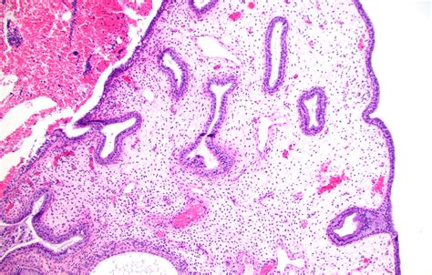 Endocervix Histology