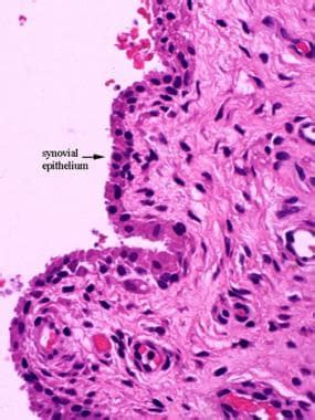 Histology of Bone: Background, Gross Structure of Long Bone, Nerves and ...