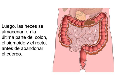 PatEdu.com : Cáncer del colon