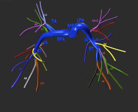 Pulmonary Artery Segmental Anatomy