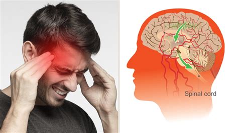 Science Explains What Happens in the Brain During a Migraine