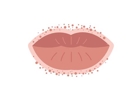 Red Spots On Lips After Kissing | Lipstutorial.org