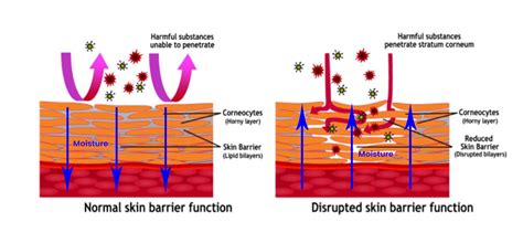 Is A Damaged Skin Barrier Causing Your Skin Issues?