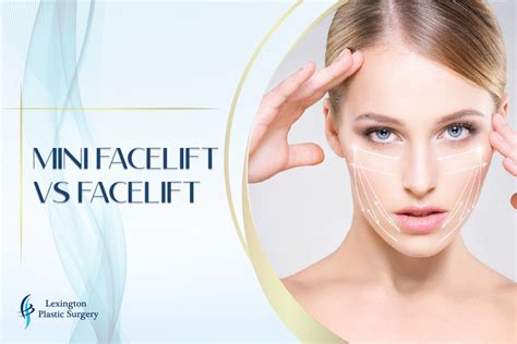 Mini Facelift vs. Facelift: Differences and Which One Is Better