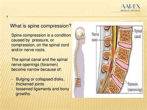 Spine Decompression Surgery