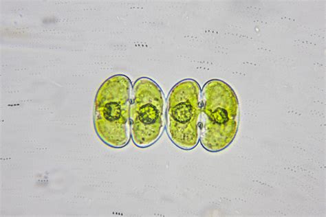 Cosmarium depressum | The Microscopic Life of Shetland Lochs