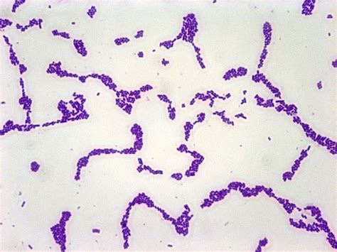 Listeria Monocytogenes Gram Stain | www.pixshark.com - Images Galleries ...