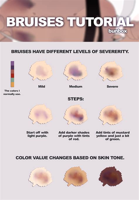 List Of Stages Of A Bruise Colors Article - CLUBCOLOR VGW