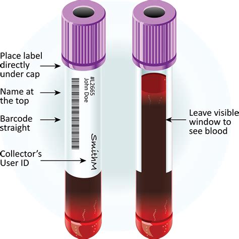 Fundamental Principle of Clinical Specimen Collection - Microbiology Notes