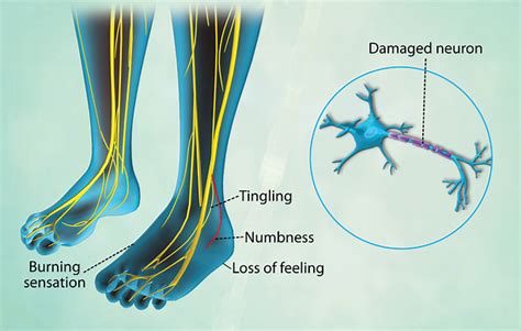 Health Condition : Symptoms, Causes, Treatment and More