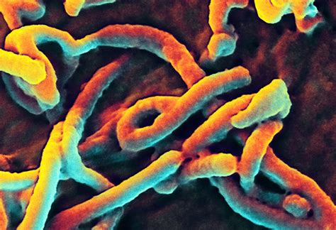 Ebola Virus | Scanning electron micrograph of Ebola virus bu… | Flickr