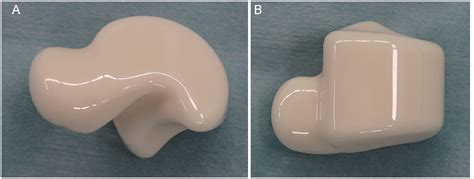 Total Talar Replacement for Idiopathic Osteonecrosis of the Talus: Investigation of Clinical ...