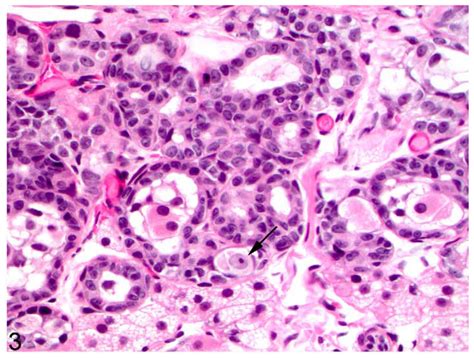 Ovotestis; cat. The cortex contains an oocyte (arrow) and adjacent ...