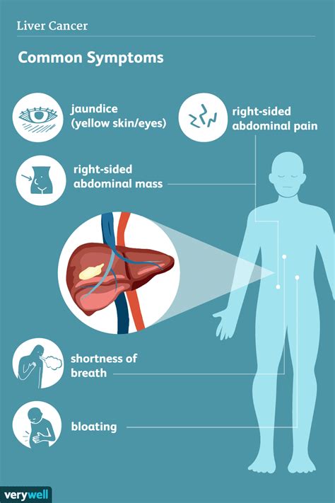 Liver Cancer: Overview and More