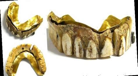 Bizarre 200-year-old gold false teeth made from hippo ivory auction ...