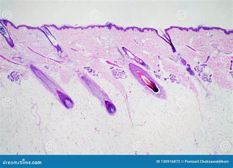 Cross Section Human Skin Head Under Microscope View for Education ...