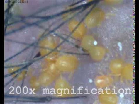 Harvest mites (Chiggers) found on my poor dog - YouTube