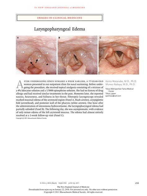 (PDF) Images in clinical medicine. Laryngopharyngeal edema