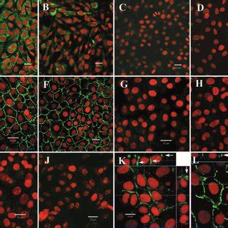 Morphology of cultured RPE cells. Cultured mouse RPE cells were... | Download Scientific Diagram