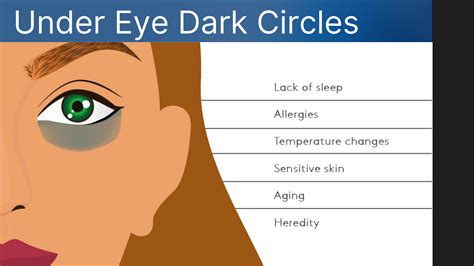 How To Get Rid Of Dark Circles Under Your Eyes - Professional Methods - Revita Skins