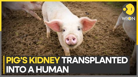 Major breakthrough as pig-to-human kidney transplant succeeds for a ...