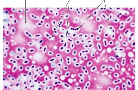 Capsule staining: Principle, Requirements, Procedure and Microscopic Examination - Online ...