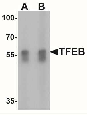 TFEB Antibodies: Novus Biologicals