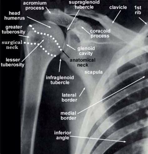 AP of the glenohumeral joint | Radiology schools, Radiology student, Radiology technologist