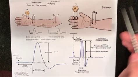 Nerve Conduction Study Video