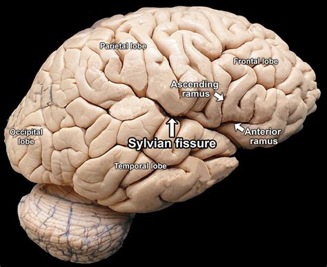 Sylvian Fissure Anatomy