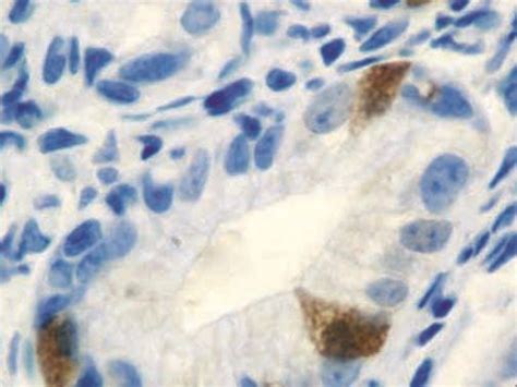 Gastrin Antibody (Polyclonal) - Bio SB