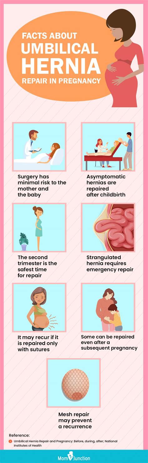 Umbilical Hernia Symptoms And Treatment – NBKomputer