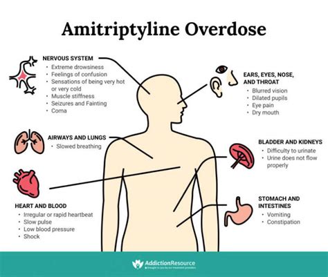 Amitriptyline Overdose: Symptoms And Treatment - Infographic Portal