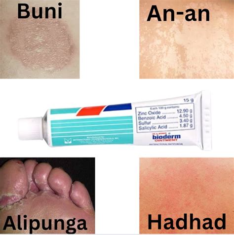 Anti-fungal Cream: Gamot sa An-an, Buni, Hadhad, Alipunga at iba pa 5g or 15g | Lazada PH