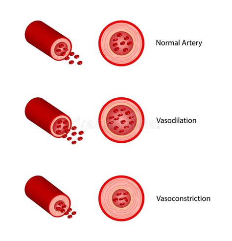 Arterial Vasoconstriction and Vasodilation. Comparison of Normal ...