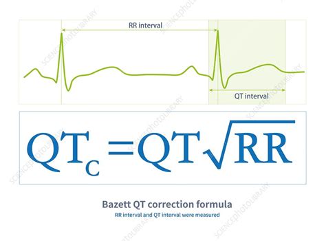 Bazett QT correction formula, illustration - Stock Image - C053/0154 - Science Photo Library