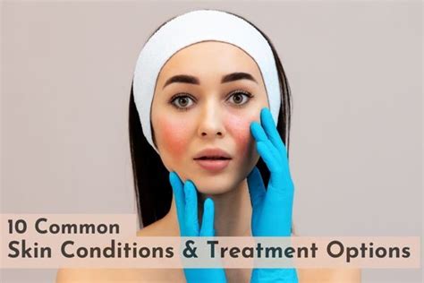 10 Common Skin Conditions & Treatment Options - SkinQure