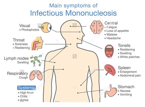 Infectious mononucleosis - MedicoInfo