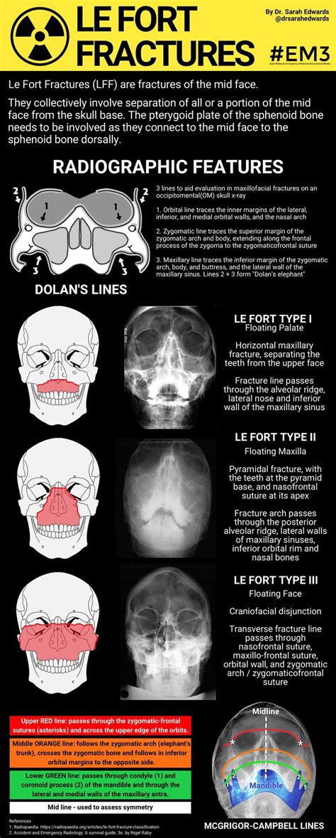 Radiology | Radiology imaging, Radiology, Radiology student