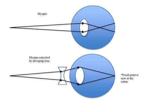 Vision - MCAT Social and Behavioral Sciences