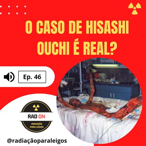 RadOn#51 - Pílula que protege contra a radiação? - Radiação para Leigos (播客) | Listen Notes