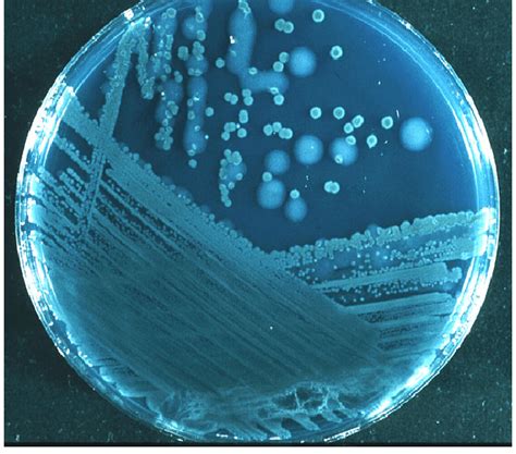 Pseudomonas Aeruginosa Colony Morphology - photos and vectors