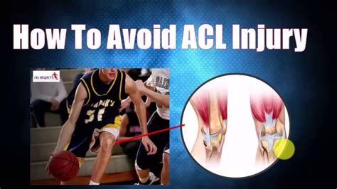 ACL Knee Injury Exercises- Identify Your Risk and Prevent Further Injury - YouTube